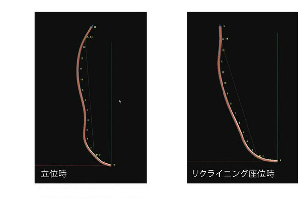 3D形状測定センサのモニタ場面　立位時・リクライニング座位時